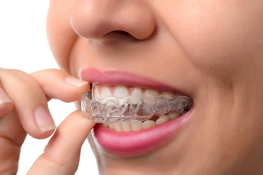 Best Orthodontists in Lahore