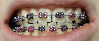 Best Orthodontists in Lahore